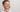 3 Reasons Behind Tooth Discoloration