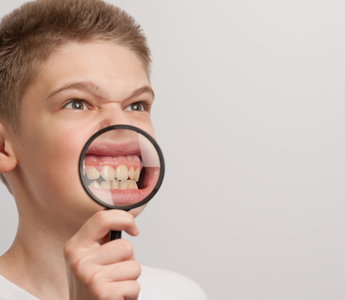 3 Reasons Behind Tooth Discoloration