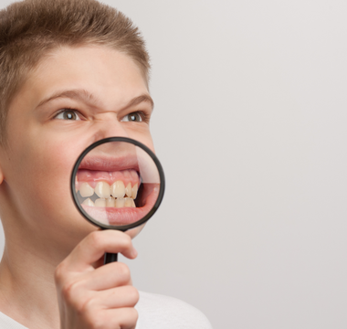 3 Reasons Behind Tooth Discoloration