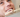 Explaining Teeth Whitening: Procedures and Options