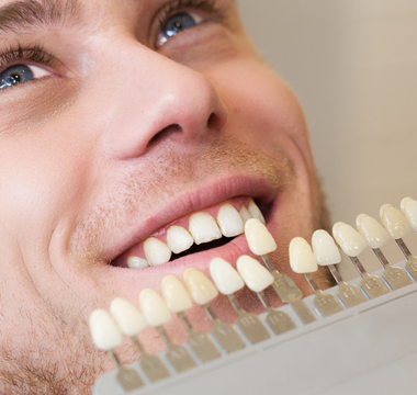 Explaining Teeth Whitening: Procedures and Options